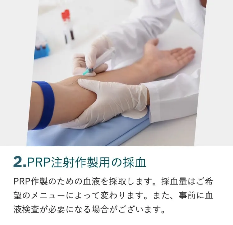 4.PRP注射の注入