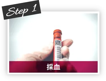 Step1 採血