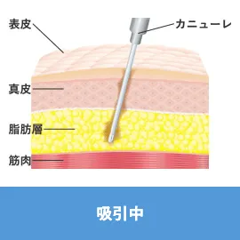 吸引中