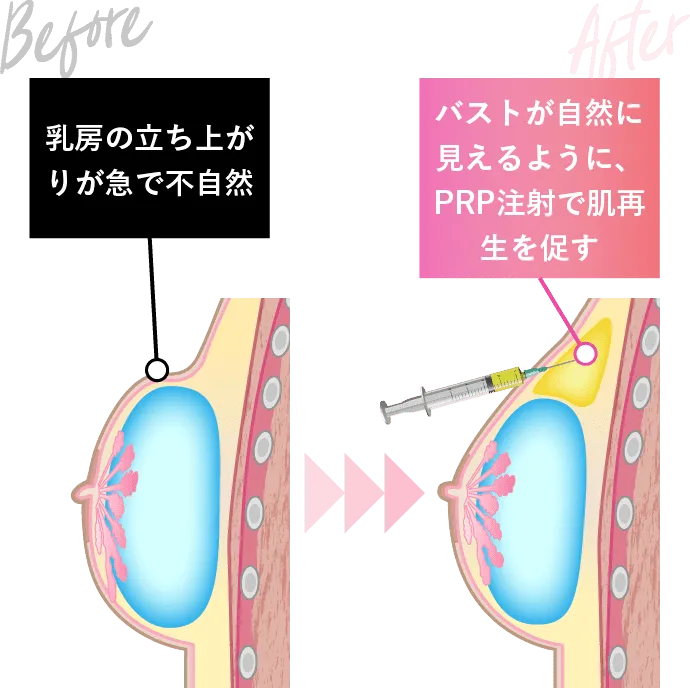 不自然な浮き上がり