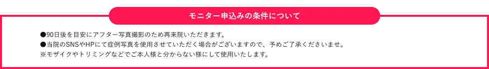 モニター申込みの場合の条件について