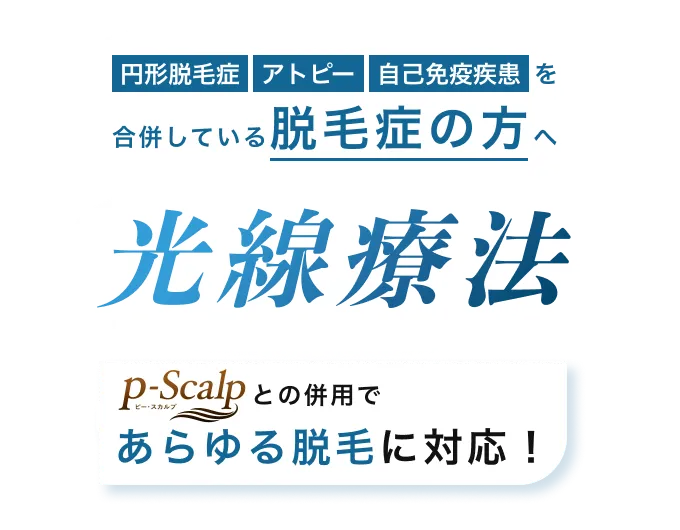 円形脱毛症 アトピー 自己免疫疾患を合併している脱毛症の方へ 光線療法 p-Scalpとの併用であらゆる脱毛に対応