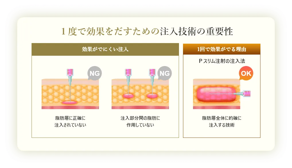 １度で効果をだすための注入技術の重要性